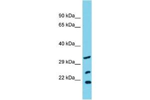 Host: Rabbit Target Name: SLC25A17 Sample Type: OVCAR-3 Whole Cell lysates Antibody Dilution: 1. (SLC25A17 antibody  (N-Term))
