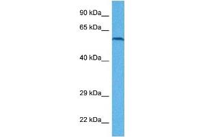 Host:  Rabbit  Target Name:  EYA1  Sample Tissue:  Human ACHN Whole Cell  Antibody Dilution:  1ug/ml (EYA1 antibody  (Middle Region))