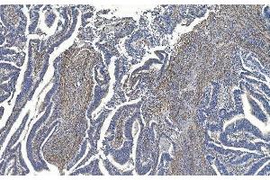 IHC analysis of Filamin A/FLNA using anti-Filamin A/FLNA antibody (ABIN7601783). (Filamin A antibody  (AA 451-638))