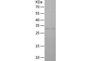 Western Blotting (WB) image for Elongation Factor, RNA Polymerase II, 2 (ELL2) (AA 350-572) protein (His tag) (ABIN7122763) (ELL2 Protein (AA 350-572) (His tag))