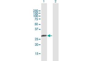 Western Blot analysis of MBNL3 expression in transfected 293T cell line by MBNL3 MaxPab polyclonal antibody. (MBNL3 antibody  (AA 1-258))