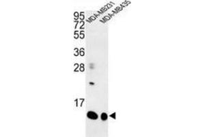 Western blot analysis of Cornifin-B (arrow) in MDA-MB231, MDA-MB435 cell line lysates (35ug/lane) using SPRR1B / Cornifin-B Antibody (C-term). (SPRR1B antibody  (C-Term))