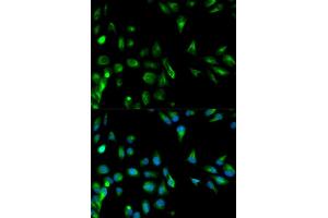 Immunofluorescence analysis of HeLa cells using RASSF1 antibody. (RASSF1 antibody)