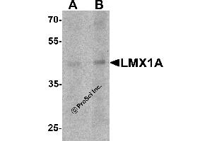 Western Blotting (WB) image for anti-LIM Homeobox Transcription Factor 1, alpha (LMX1A) (C-Term) antibody (ABIN1077395) (LMX1A antibody  (C-Term))