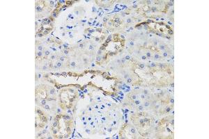 Immunohistochemistry of paraffin-embedded rat kidney using B9D1 antibody. (B9D1 antibody)