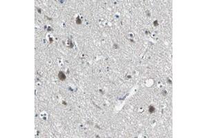 Immunohistochemical staining of human cerebral cortex with SLC16A7 polyclonal antibody  shows moderate cytoplasmic positivity in neuronal cells.