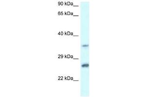 Western Blot showing CBR4 antibody used at a concentration of 1 ug/ml against Jurkat Cell Lysate (CBR4 antibody  (C-Term))