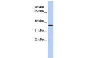 Image no. 1 for anti-Mevalonate Kinase (MVK) (AA 107-156) antibody (ABIN6743974)