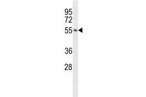 PGA3 antibody western blot analysis in MDA-MB231 lysate. (PGA3 antibody  (AA 45-73))