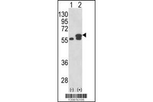 Western blot analysis of PDIA3 using rabbit polyclonal PDIA3 Antibody using 293 cell lysates (2 ug/lane) either nontransfected (Lane 1) or transiently transfected with the PDIA3 gene (Lane 2). (PDIA3 antibody  (AA 192-220))