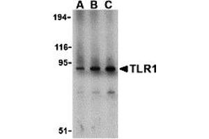Western Blotting (WB) image for anti-Toll-Like Receptor 1 (TLR1) (N-Term) antibody (ABIN1031619) (TLR1 antibody  (N-Term))