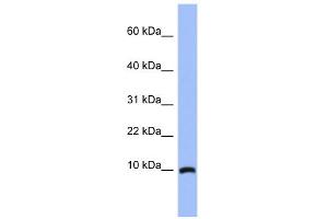 WB Suggested Anti-ACBD7 Antibody Titration: 0. (ACBD7 antibody  (N-Term))