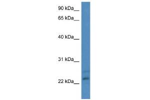 WB Suggested Anti-CBR4 Antibody Titration: 0. (CBR4 antibody  (N-Term))