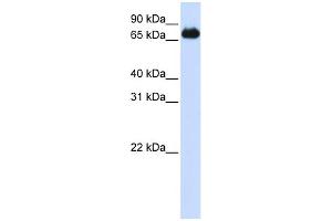 WB Suggested Anti-FOXK2 Antibody Titration:  0. (Forkhead Box K2 antibody  (Middle Region))