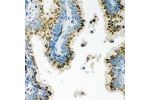 Immunohistochemical analysis of Unc18-2 staining in human prostate formalin fixed paraffin embedded tissue section.