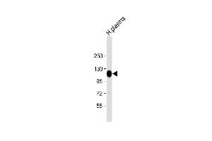 Anti-ITIH4 Antibody (C-Term) at 1:2000 dilution + human plasma lysate Lysates/proteins at 20 μg per lane. (ITIH4 antibody  (AA 885-917))