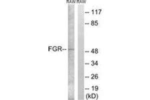 Western blot analysis of extracts from RAW264. (Fgr antibody  (AA 381-430))