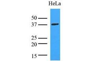 Cell lysates of HeLa (35 ug) were resolved by SDS-PAGE, transferred to nitrocellulose membrane and probed with anti-human LDHA (1:8000). (Lactate Dehydrogenase A antibody  (AA 1-332))