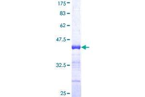 RFX5 Protein (AA 516-616) (GST tag)