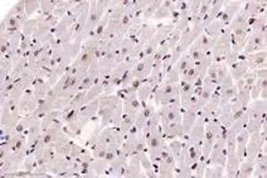 Immunohistochemistry (Paraffin-embedded Sections) (IHC (p)) image for anti-DAZ Associated Protein 1 (DAZAP1) antibody (ABIN7073691)