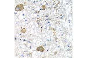 Immunohistochemistry of paraffin-embedded rat brain using IFNL3 antibody at dilution of 1:100 (40x lens). (IL28B antibody)