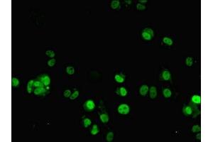 Immunofluorescent analysis of MCF-7 cells using ABIN7176421 at dilution of 1:100 and Alexa Fluor 488-congugated AffiniPure Goat Anti-Rabbit IgG(H+L) (ZNF596 antibody  (AA 201-504))