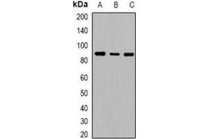 Western blot analysis of Cadherin 20 expression in HeLa (A), mouse liver (B), rat liver (C) whole cell lysates. (Cadherin 20 antibody)