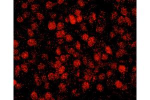 Immunofluorescence (IF) image for anti-REST Corepressor 3 (RCOR3) (AA 445-495) antibody (ABIN7449047) (RCOR3 antibody  (AA 445-495))