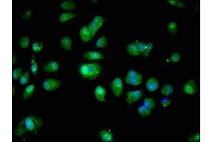 Immunofluorescent analysis of MCF-7 cells using ABIN7166049 at dilution of 1:100 and Alexa Fluor 488-congugated AffiniPure Goat Anti-Rabbit IgG(H+L) (S1A16 (AA 1-103) antibody)