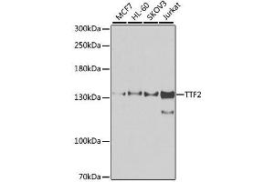 Western blot analysis of extracts of various cell lines, using TTF2 antibody.