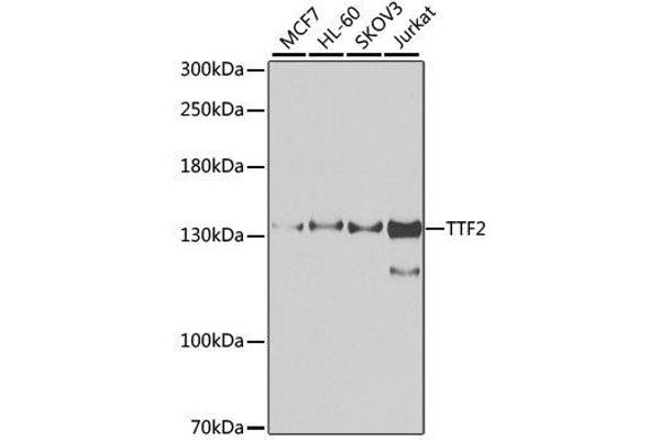 TTF2 抗体  (AA 1-270)
