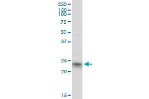 RRAS2 monoclonal antibody (M01), clone 2D3-4B8. (RRAS2 antibody  (AA 1-204))