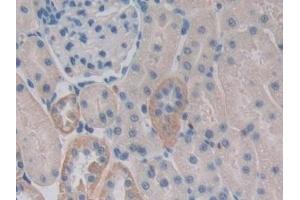 Detection of CENTa2 in Rat Kidney Tissue using Polyclonal Antibody to Centaurin Alpha 2 (CENTa2) (ADAP2 antibody  (AA 49-360))