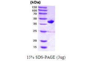 SDS-PAGE (SDS) image for Ras-Related C3 Botulinum Toxin Substrate 2 (Rho Family, Small GTP Binding Protein Rac2) (RAC2) (AA 1-192) protein (GST tag) (ABIN667712)