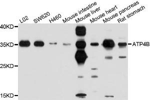 Western blot analysis of extracts of various cells, using ATP4B antibody. (ATP4b antibody)