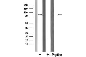 Western blot analysis of MRE11A expression in Rat heart lysate