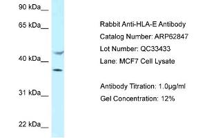 Western Blotting (WB) image for anti-HLA Class I Histocompatibility Antigen, alpha Chain E (HLA-E) (C-Term) antibody (ABIN2789266) (HLA-E antibody  (C-Term))