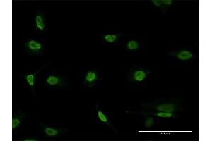 Immunofluorescence of monoclonal antibody to PAX8 on HeLa cell. (PAX8 antibody  (AA 141-250))