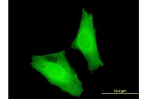 Immunofluorescence of monoclonal antibody to MAF on HeLa cell. (MAF antibody  (AA 304-403))