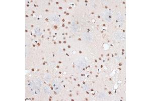 Immunohistochemistry of paraffin-embedded mouse brain using RBM3 antibody  at dilution of 1:100 (40x lens). (RBM3 antibody  (AA 1-157))
