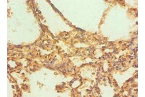 Immunohistochemistry of paraffin-embedded human lung tissue using ABIN7146530 at dilution of 1:100 (CAPNL1 antibody  (Catalytic Subunit))