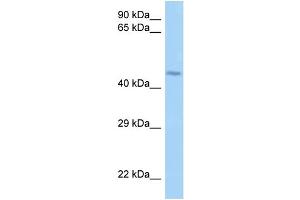 WB Suggested Anti-LRRFIP2 Antibody Titration: 1. (LRRFIP2 antibody  (N-Term))