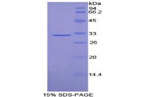 SDS-PAGE analysis of Rat Tubulin delta Protein.