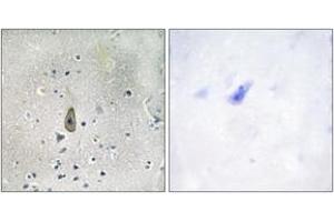 Immunohistochemistry analysis of paraffin-embedded human brain, using ROMK/Kir1. (KCNJ1 antibody  (pSer44))