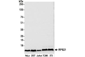 anti-Ribosomal Protein S21 (RPS21) (AA 1-50) antibody