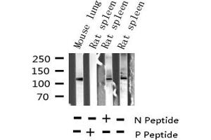 Western blot analysis of Phospho-JAK2 (Tyr221) expression in various lysates (JAK2 antibody  (pTyr221))
