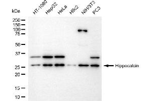 Western blotting analysis using hippocalcin antibody (ABIN7798912).