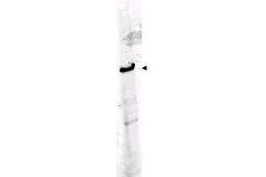 Western Blotting (WB) image for anti-Roundabout, Axon Guidance Receptor, Homolog 1 (ROBO1) (AA 1625-1650) antibody (ABIN129621)