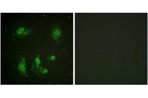 Immunofluorescence analysis of HeLa cells, using Survivin (Ab-117) Antibody. (Survivin antibody  (AA 86-135))