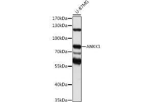 Western blot analysis of extracts of U-87MG cells, using  antibody (ABIN7265605) at 1:1000 dilution. (ANKK1 antibody  (AA 1-300))